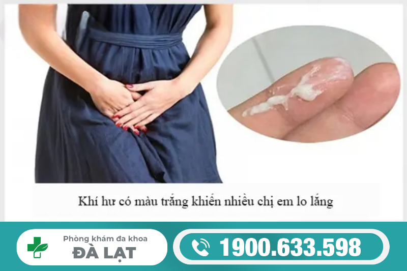 Hình ảnh minh họa